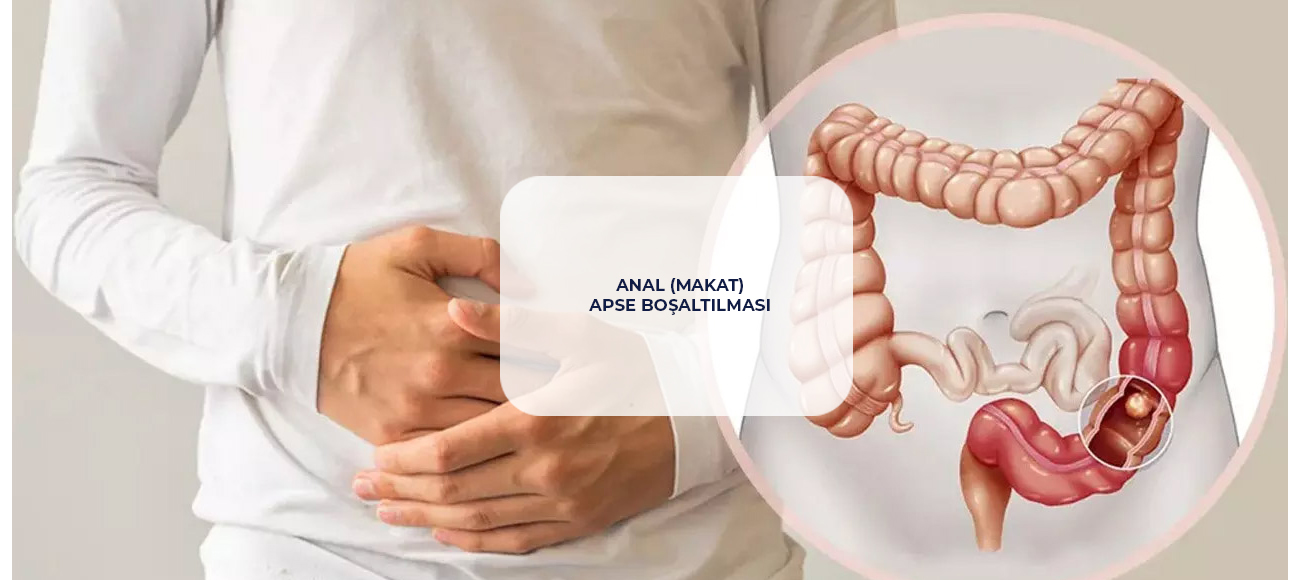 Anal Abscess Drainage